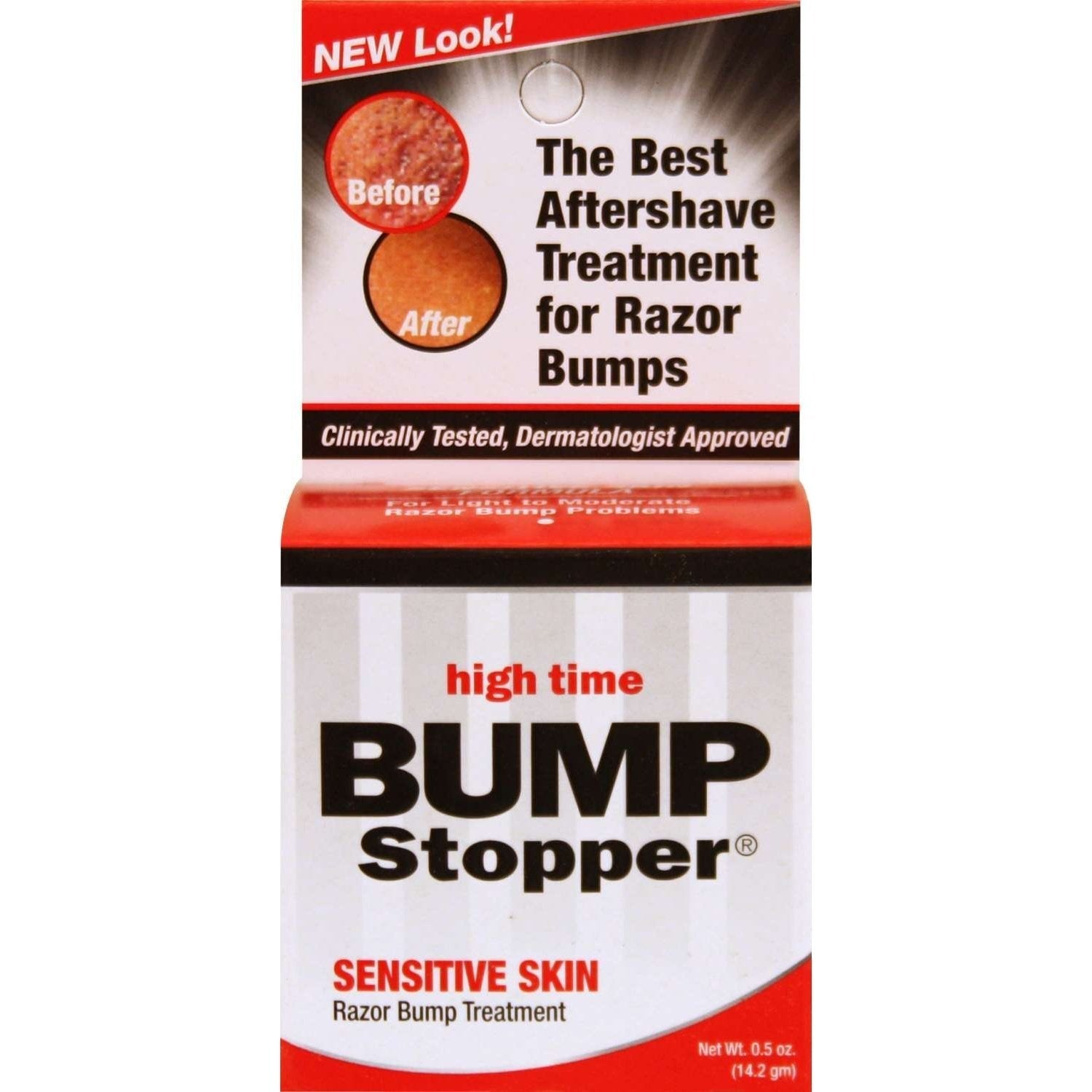 Bump Stopper Razor Bump Treatment Sensitive Skin Care Formula Bump Stopper Razor Bump Treatment Sensitive Skin Care Formula